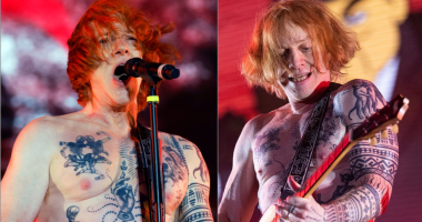 Did Danny Elfman Undergo Weight Loss Surgery?