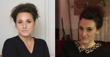 Did Grace Dent Undergo Surgery On Her Teeth?