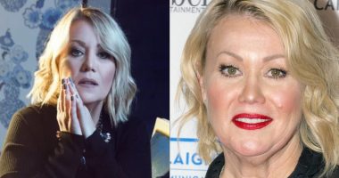 Did Jann Arden Undergo Weight Loss Surgery Or Not?
