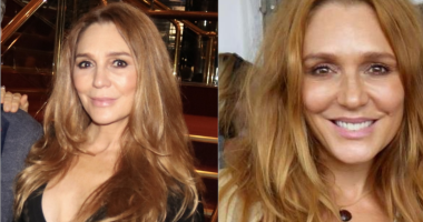 Did Tottie Goldsmith Undergo Plastic Surgery On Her Face?