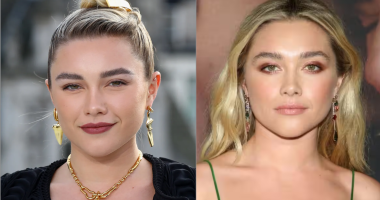 Does Florence Pugh Have Gap Teeth (Diastema)?