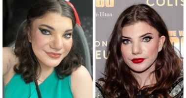 Does Elphaba Orion Doherty Have Any Disability: Was She Autistic?