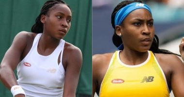 Has Coco Gauff Undergone Plastic Surgery Or Not?