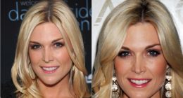 Has Tinsley Mortimer Done Plastic Surgery?