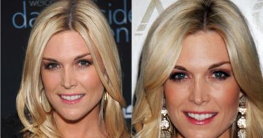 Has Tinsley Mortimer Done Plastic Surgery?