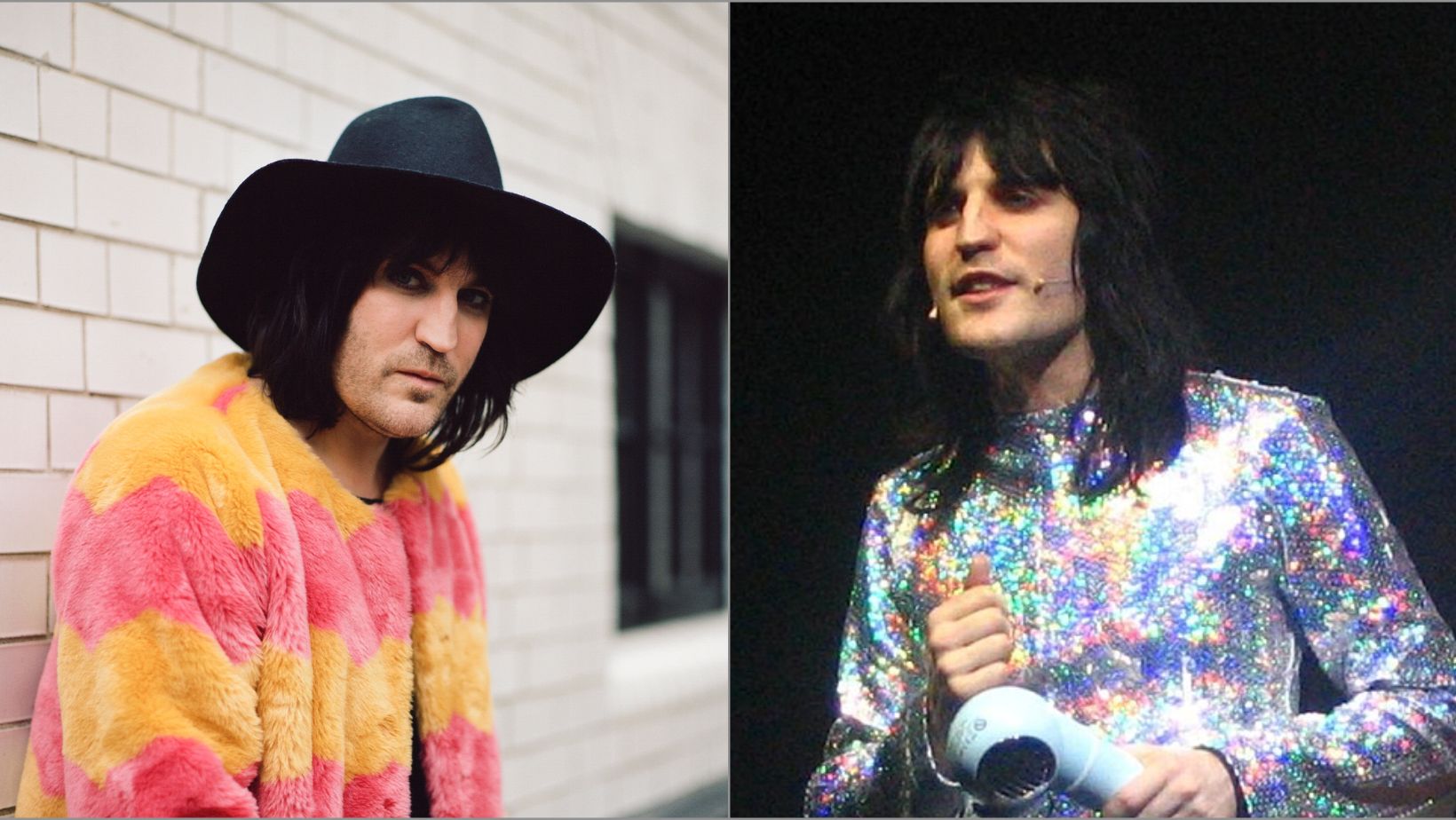 What Illness Does Noel Fielding Have Is He Sick? Hepatitis Rumor