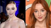 What Is Wrong With Actress Phoebe Dynevor Teeth?