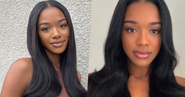 What Is Wrong With Eliza Isichei Tooth? Before And After Photos