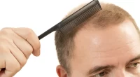 Is Hereditary Baldness Preventable? Unraveling the Genetic Code