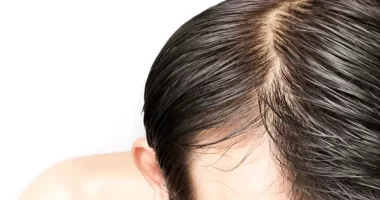 Nutrition Solutions For Common Skin And Hair Problems