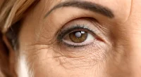 Non-Surgical Alternatives To Eyelid Surgery