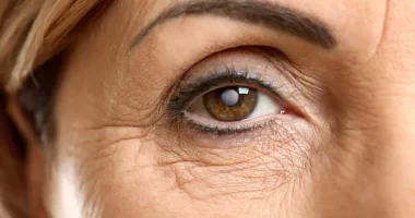 Non-Surgical Alternatives To Eyelid Surgery