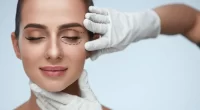 What To Know Before And After Blepharoplasty (Eyelid) Surgery: Is It Worth It?