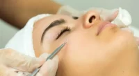 12 Questions To Ask Before Getting Dermal Fillers