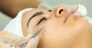12 Questions To Ask Before Getting Dermal Fillers