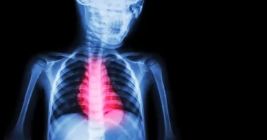 Unlocking the Mysteries of Ischemic Cardiomyopathy: A Deep Dive into the ICD-10 Code