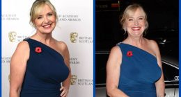 Carol Kirkwood Weight Loss Journey: Did She Undergo Surgery?