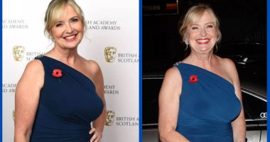 Carol Kirkwood Weight Loss Journey: Did She Undergo Surgery?