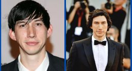 Did Adam Driver Undergo Ear Plastic Surgery?