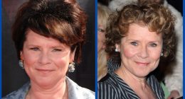 Did Imelda Staunton Undergo Plastic Surgery?