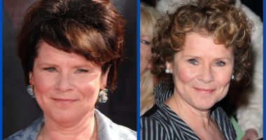 Did Imelda Staunton Undergo Plastic Surgery?