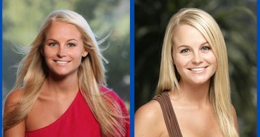 Did Jordan Lloyd Undergo Facial Plastic Surgery?
