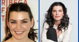 Did Julianna Margulies Undergo Facial Plastic Surgery?