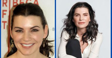 Did Julianna Margulies Undergo Facial Plastic Surgery?
