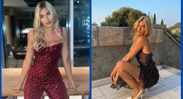 Did Nicole Berry Made In Chelsea Cast Undergo Plastic Surgery?