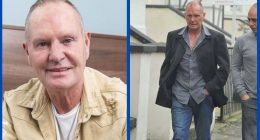 Did Paul Gascoigne Undergo Plastic Surgery?