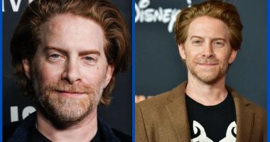 Did Seth Green Undergo Plastic Surgery On His Nose?