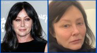Did Shannen Doherty Undergo Teeth Whitening Surgery?