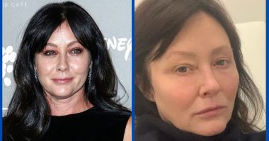 Did Shannen Doherty Undergo Teeth Whitening Surgery?