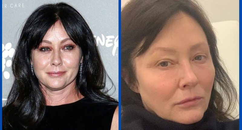 Did Shannen Doherty Undergo Teeth Whitening Surgery? Wiki Bio And ...