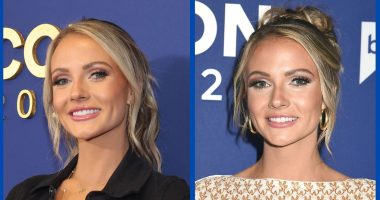 Did Taylor Ann Green Undergo Plastic Surgery?