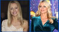 Did Tess Daly Undergo Plastic Surgery Or Not?