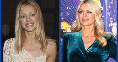Did Tess Daly Undergo Plastic Surgery Or Not?