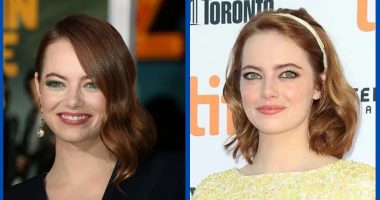 Has Emma Stone Undergone Plastic Surgery?