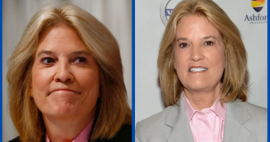 Has Greta Van Susteren Undergone Plastic Surgery?