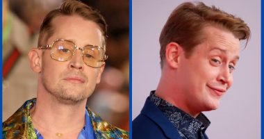 Has Macaulay Culkin Done Plastic Surgery On His Face?