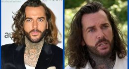 Has Pete Wicks Undergone Plastic Surgery On His Face?