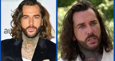 Has Pete Wicks Undergone Plastic Surgery On His Face?