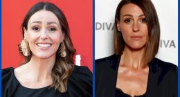 Has Suranne Jones Done Plastic Surgery?