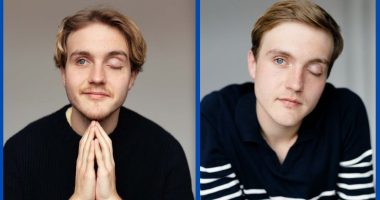 Kjell Brutscheidt Eye Accident And Surgery: What Happened?