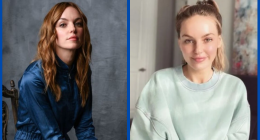 Michelle Mylett Plastic Surgery Before And After: What Happened To Her Lips?