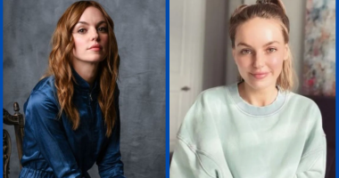 Michelle Mylett Plastic Surgery Before And After: What Happened To Her Lips?