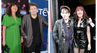 Shane MacGowan Wife: What Is Wrong With Victoria Mary Clarke Teeth? Before And After