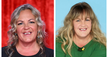 What Happened Lorraine Stanley Teeth? Illness And Health 2023