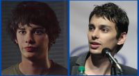 What Is Wrong With Actor Devon Bostick Face?