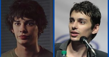 What Is Wrong With Actor Devon Bostick Face?